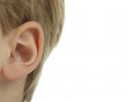 Glue ear explained Glue ear explained