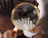 Checking for head lice Checking for head lice