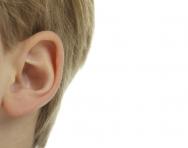 Glue ear explained