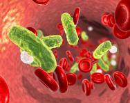 Sepsis and bacteria in blood