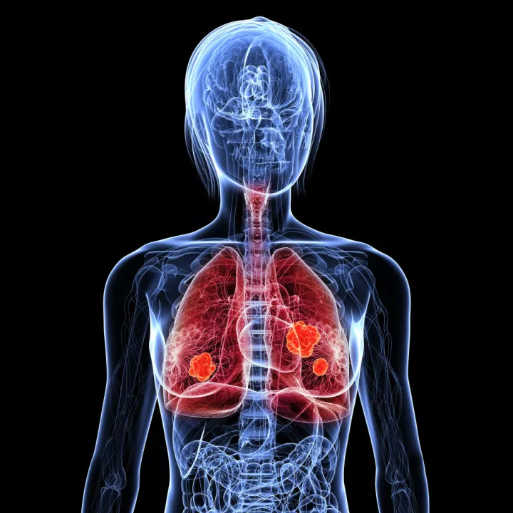 Human respiratory system Homework Gnome Human respiratory system Homework Gnome